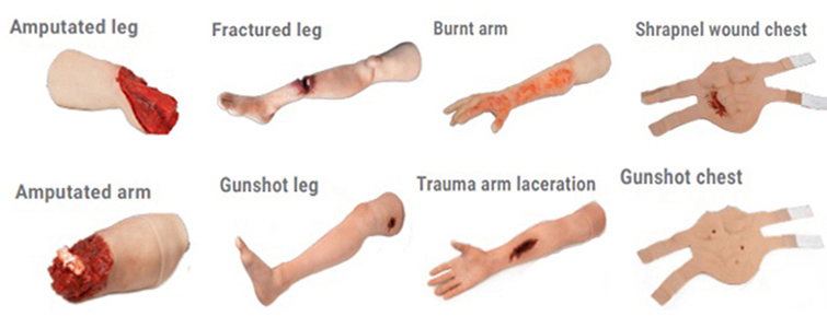 trauma-limbs