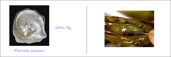 Pearl Implant Process