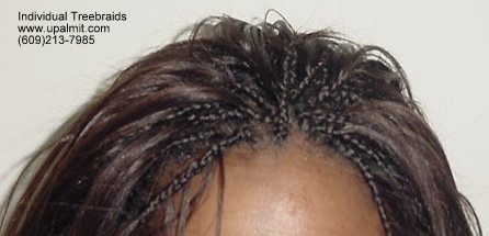 Straight individual treebraids, Top106.