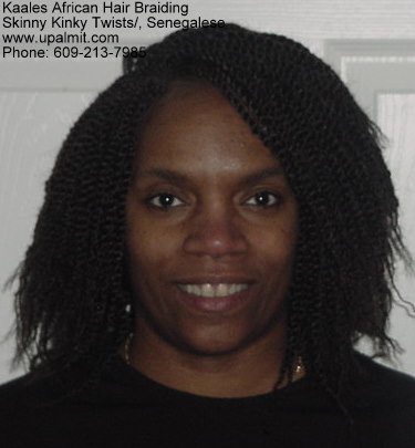 Kinky twists for receding hairline and male pattern baldness.