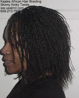 Kinky twists for receding hairline and male pattern baldness- 24hrs.