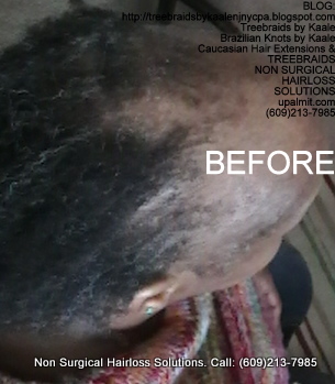 Tree Braids- Cornrows with fluffy Kinky Curly human hair BEFORE, Right.