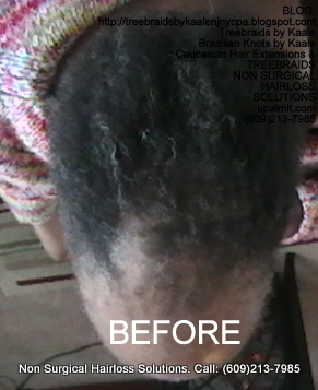 Tree Braids- Cornrows with fluffy Kinky Curly human hair BEFORE Top.