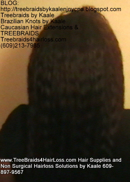TreeBraids4HairLoss.com- Non-Surgical Hair Loss Solutions at Kaales, Back side.