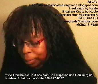 TreeBraids4HairLoss.com- Hair Club For Women at Kaales, Left side.