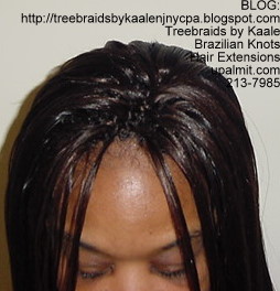 Straight Mediumsmall Treebraids- Top.