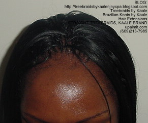 Straight Tree Braids, Top103.