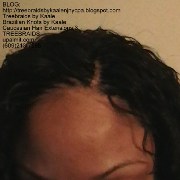 Tree Braids with KAALE human hair- Invisible hair line at part.
