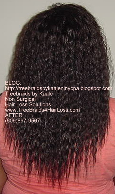 TreeBraids4HairLoss.com- Hair Club For Women at Kaales, Back side.