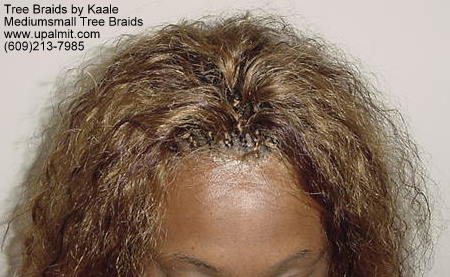 Tree Braids- Top.