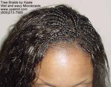 Microbraids, Top 15.