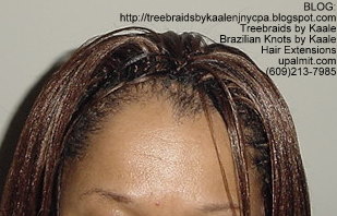 Straight Tree Braids- Top.