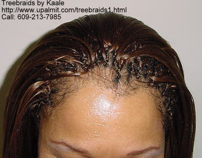 Treebraids.