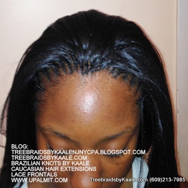 Treebraids with straight hair (Fr).