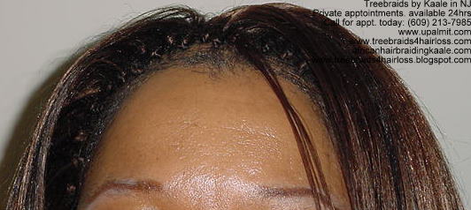 Treebraids- straight treebraids, not posed- top view.