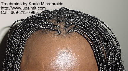 Microbraids, or crown of head10.