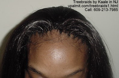 Treebraids.