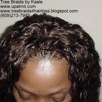 Summer, vacation, and beach wet and wavy Tree Braids- top2.