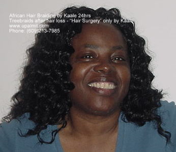 Hair loss after treebraids non surgical hair loss solutions by Kaale.