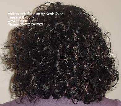 Hair loss after treebraids- back view.