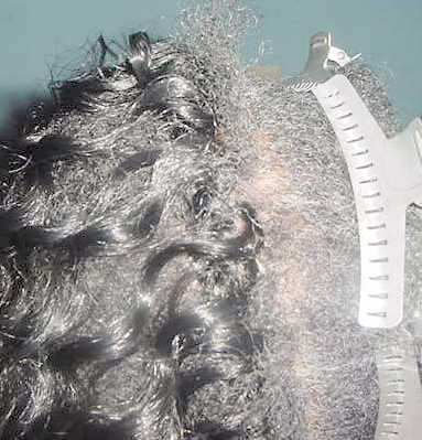 Hair loss before and after treebraids.