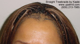 Treebraids- straight treebraids, side view.