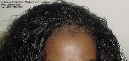 Individual treebraids 1.