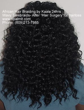 Hair loss back view after treebraids non surgical hair loss solutions by Kaale.