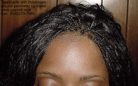 Wet and wavy treebraids with invisible part.