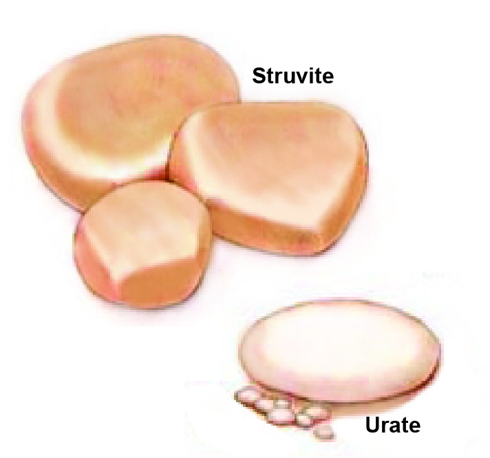 Struvic & Urate Stones