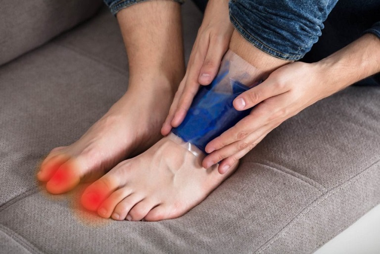 gout attack