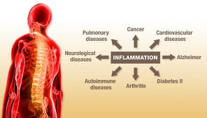 Inflammatory Disease Chart of Information