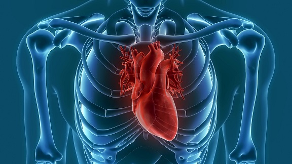 heart disease