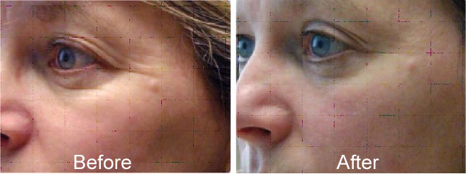 rejuv2.jpg (45547 bytes)