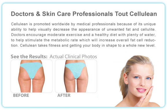 Cellulean Cellulite Reduction