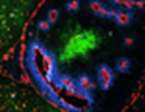 Immunofluorescence staining of a frozen section of a rat brain tumor.