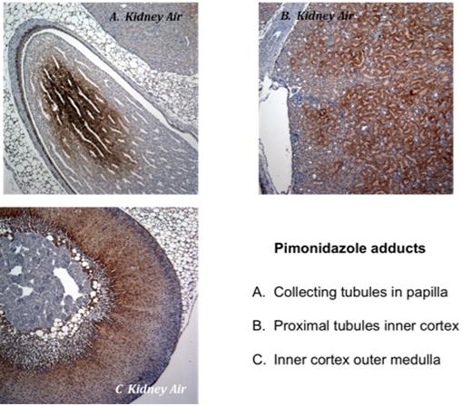 Pimonidazole Adducts