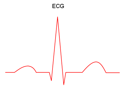 ECG animation in PowerPoint